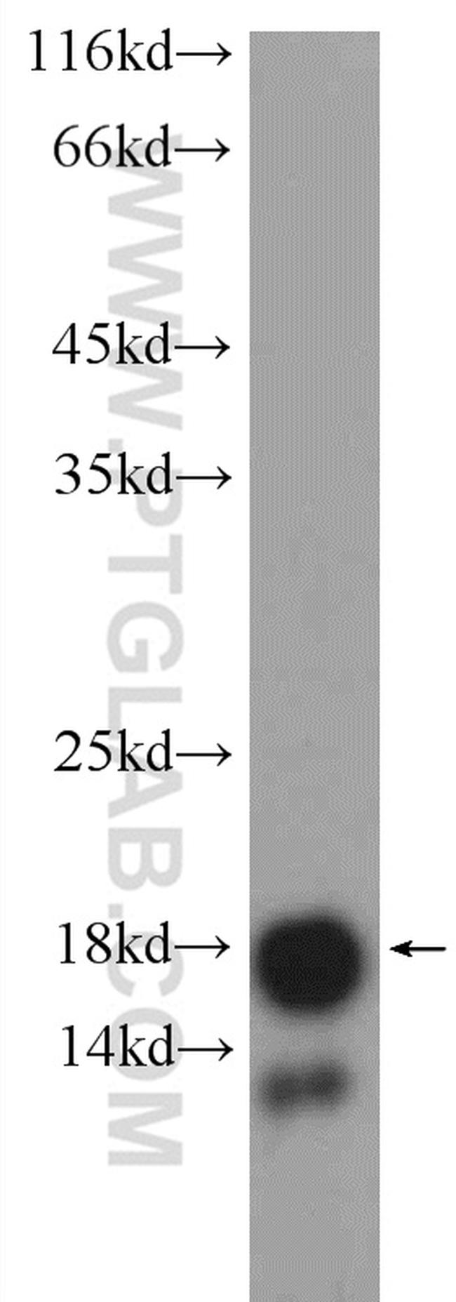 C9orf46 Antibody in Western Blot (WB)