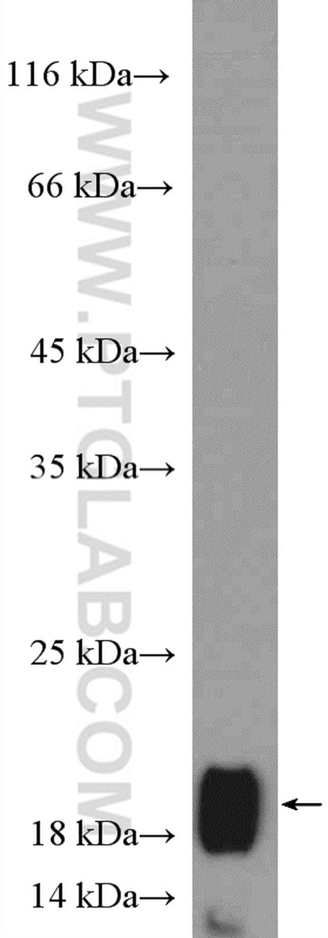 C9orf46 Antibody in Western Blot (WB)