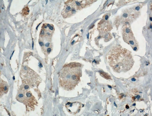 MAPK4 Antibody in Immunohistochemistry (Paraffin) (IHC (P))