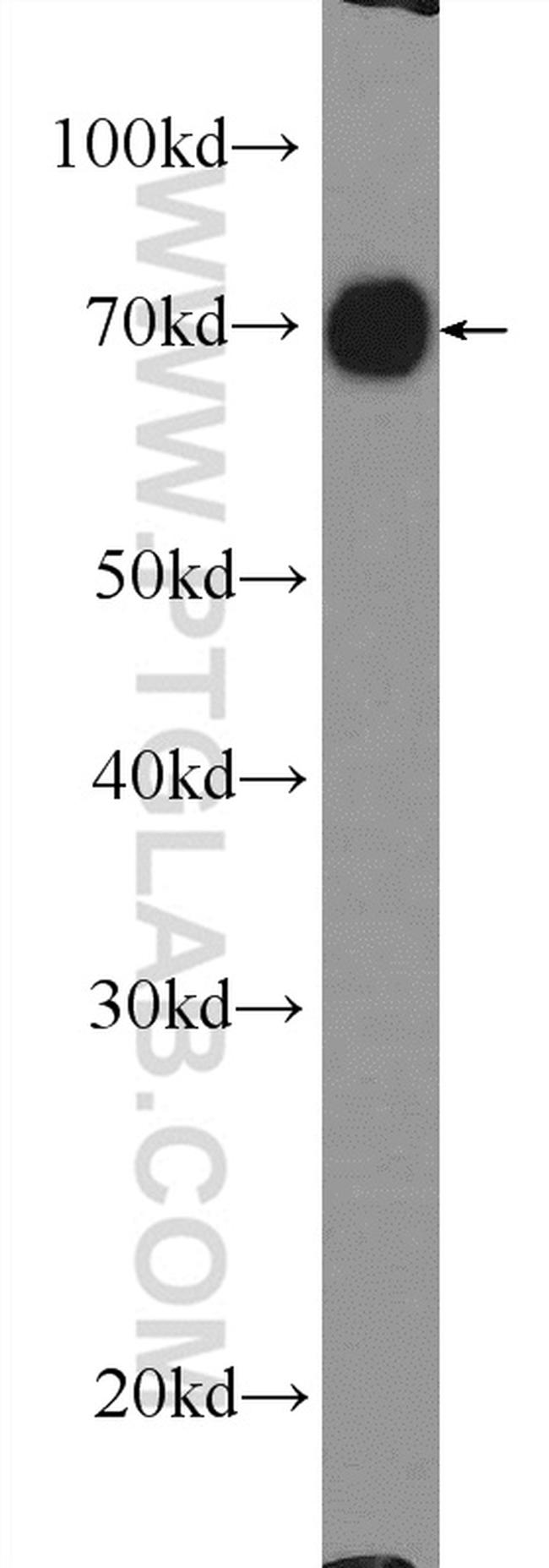 RDX Antibody in Western Blot (WB)