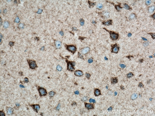 LRP1 Antibody in Immunohistochemistry (Paraffin) (IHC (P))