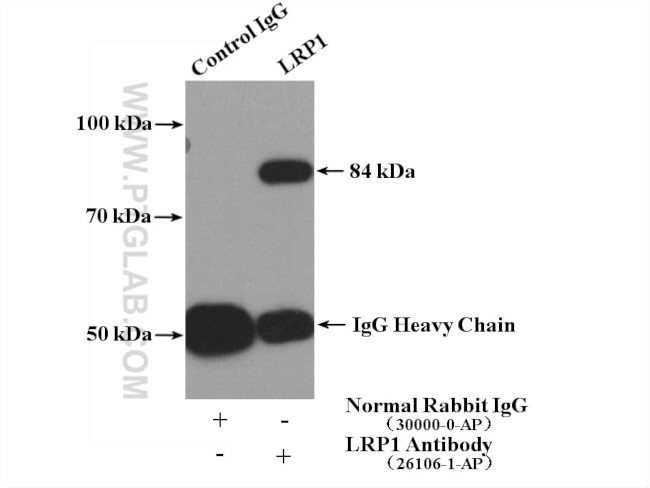 LRP1 Antibody in Immunoprecipitation (IP)