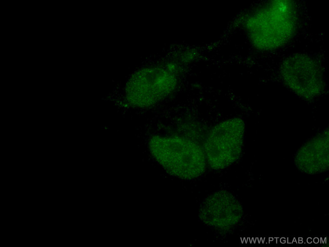 C1orf58 Antibody in Immunocytochemistry (ICC/IF)