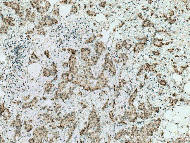 C1orf58 Antibody in Immunohistochemistry (Paraffin) (IHC (P))