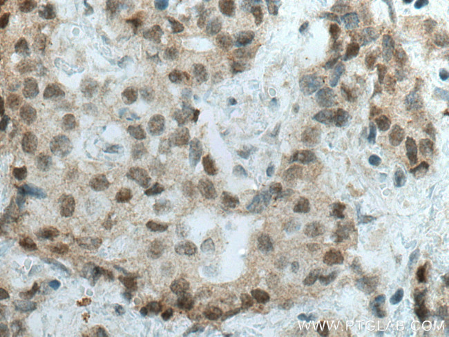 C1orf58 Antibody in Immunohistochemistry (Paraffin) (IHC (P))