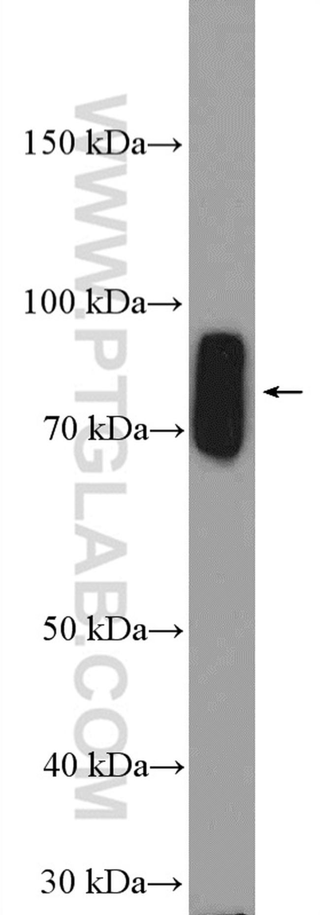 ZFP90 Antibody in Western Blot (WB)