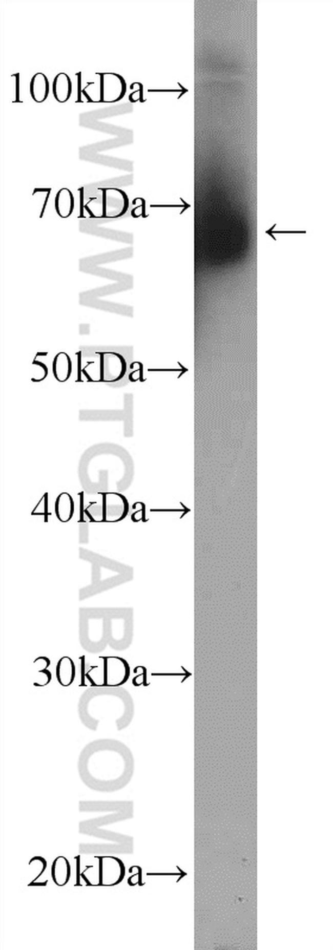 ZFP90 Antibody in Western Blot (WB)