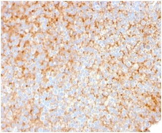 SERBP1/PAI-RBP1 Antibody in Immunohistochemistry (Paraffin) (IHC (P))