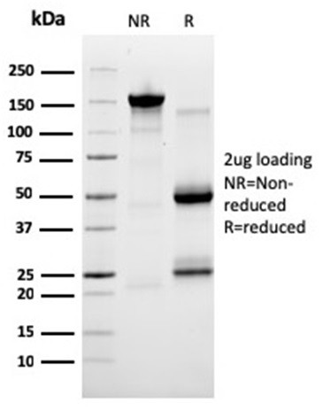 SERBP1/PAI-RBP1 Antibody in SDS-PAGE (SDS-PAGE)