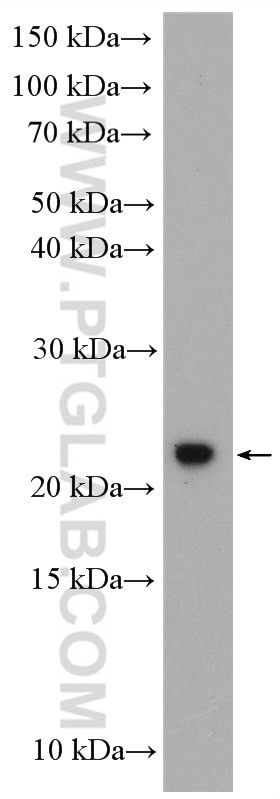 C1orf86 Antibody in Western Blot (WB)