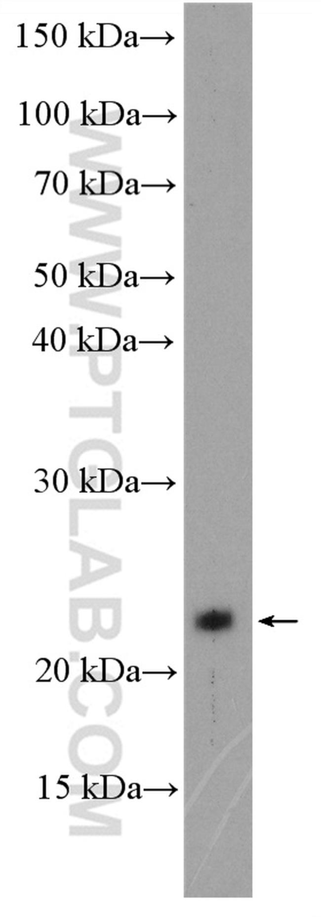 C1orf86 Antibody in Western Blot (WB)