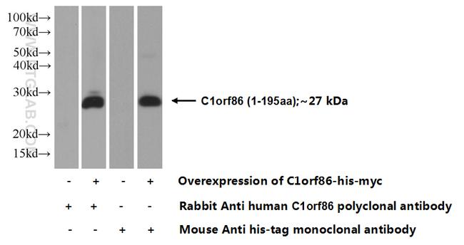 C1orf86 Antibody in Western Blot (WB)