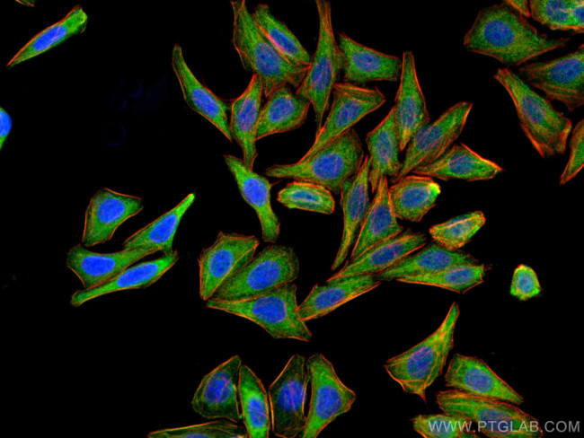 NBCe2 Antibody in Immunocytochemistry (ICC/IF)