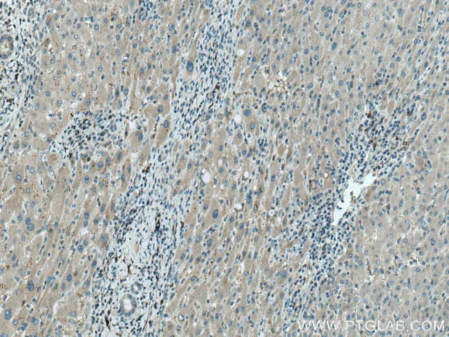 NBCe2 Antibody in Immunohistochemistry (Paraffin) (IHC (P))