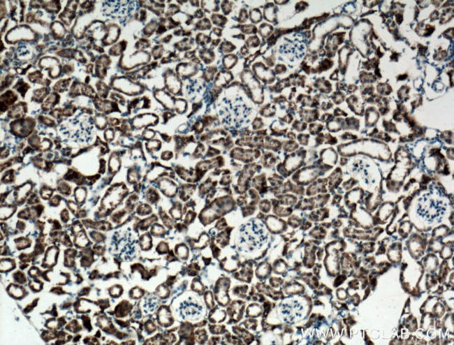 NBCe2 Antibody in Immunohistochemistry (Paraffin) (IHC (P))