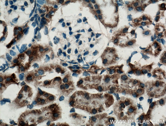 NBCe2 Antibody in Immunohistochemistry (Paraffin) (IHC (P))