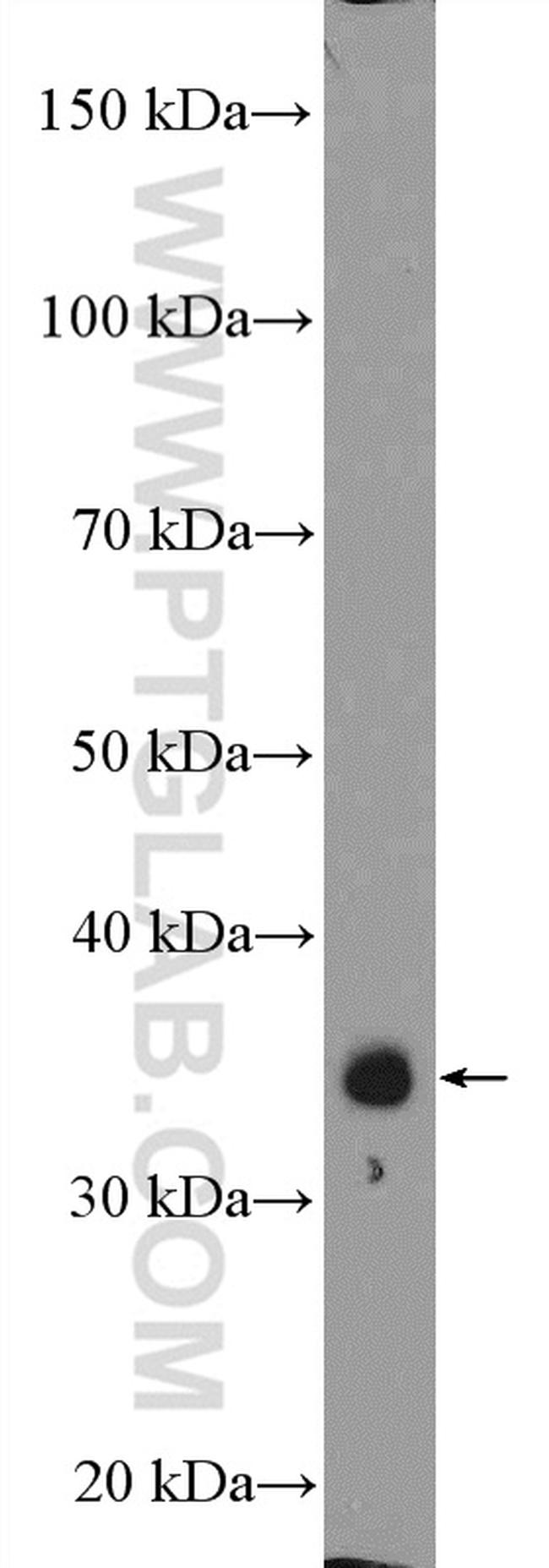 ZC3H8 Antibody in Western Blot (WB)