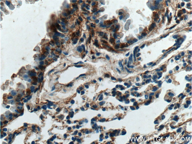 Vegfa Antibody in Immunohistochemistry (Paraffin) (IHC (P))