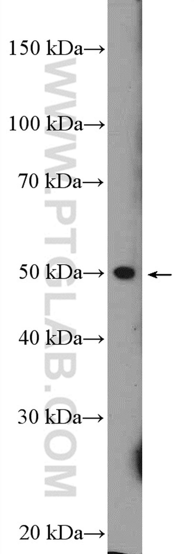 METTL14 Antibody in Western Blot (WB)