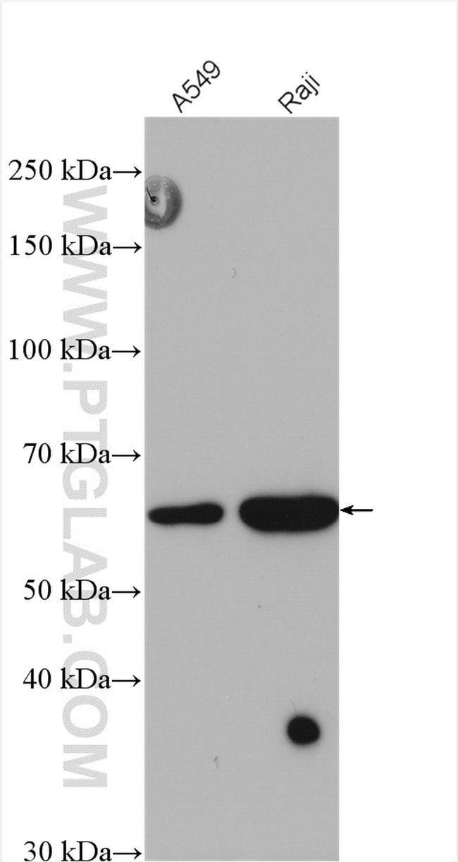 METTL14 Antibody in Western Blot (WB)