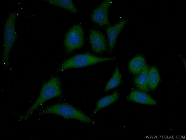 Mcp1 Antibody in Immunocytochemistry (ICC/IF)