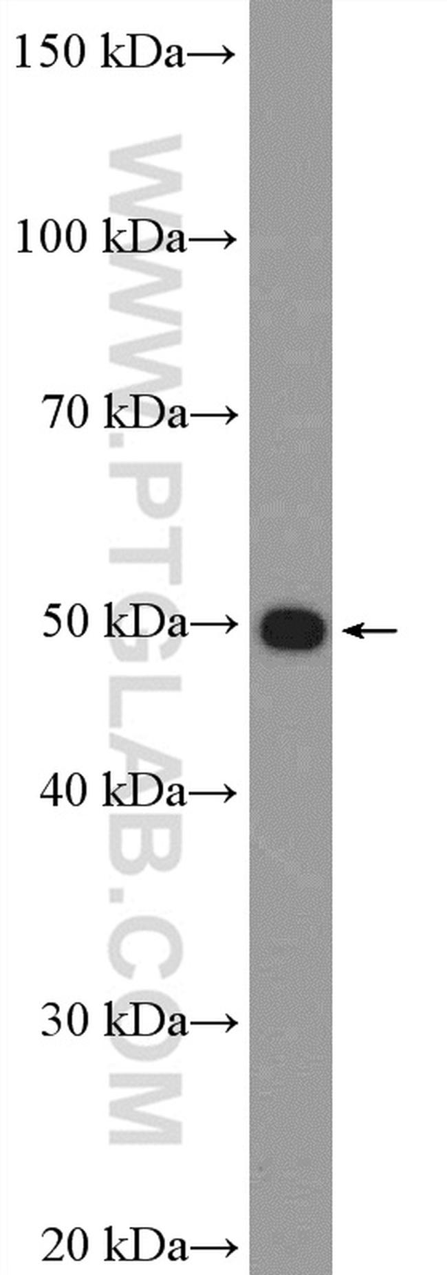 NCAPH2 Antibody in Western Blot (WB)