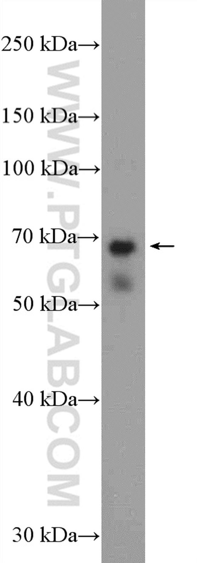 NCAPH2 Antibody in Western Blot (WB)