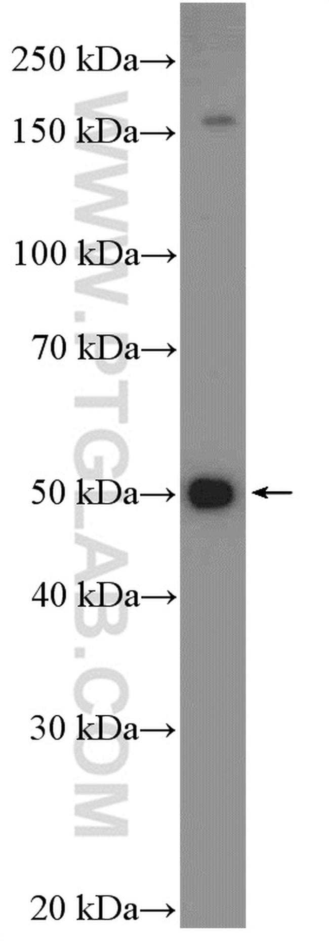 NCAPH2 Antibody in Western Blot (WB)