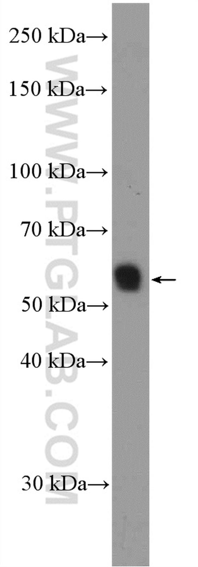 NCAPH2 Antibody in Western Blot (WB)