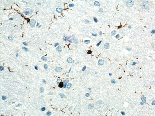 IBA1 Antibody in Immunohistochemistry (Paraffin) (IHC (P))