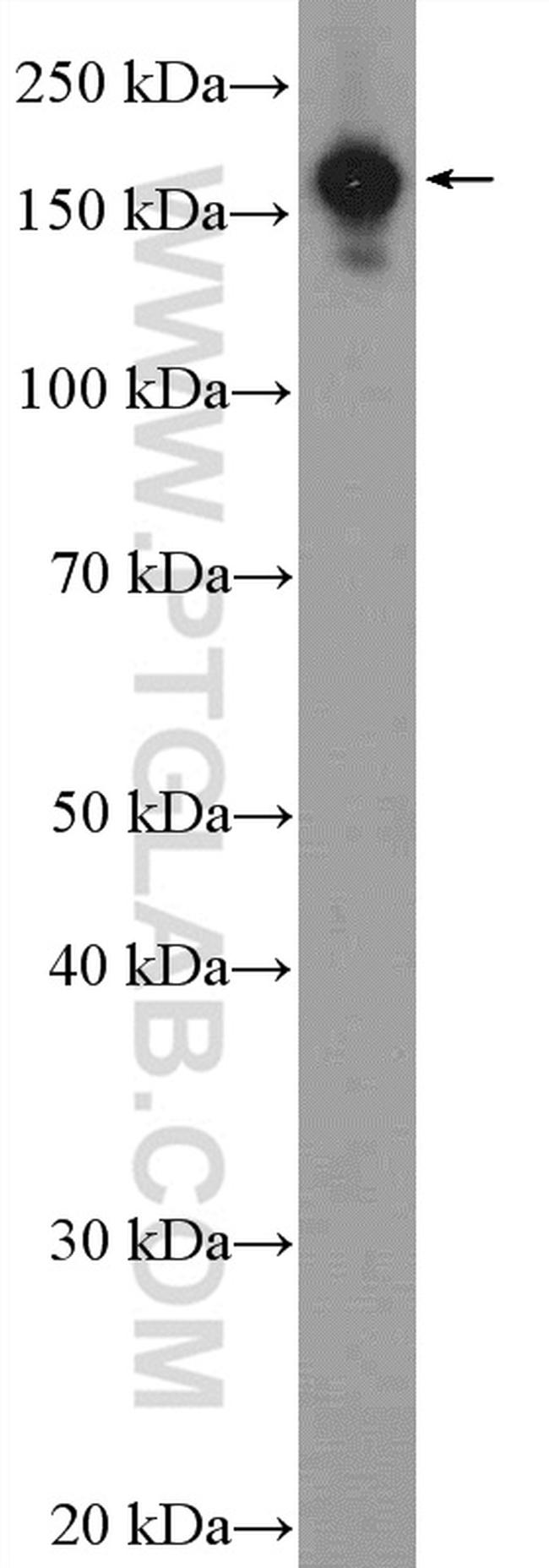 EIF3A Antibody in Western Blot (WB)