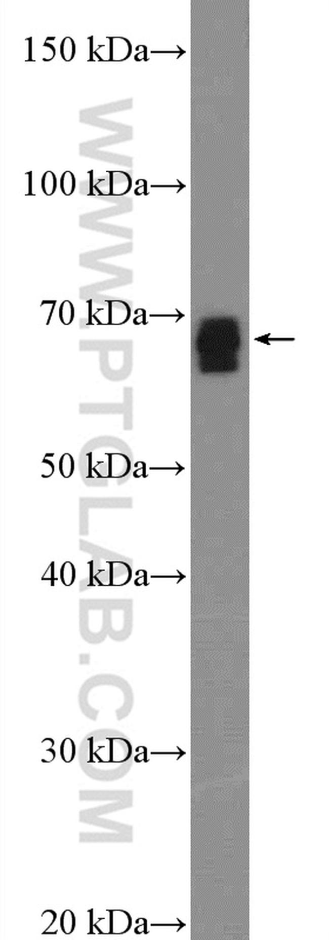 SLC13A3 Antibody in Western Blot (WB)