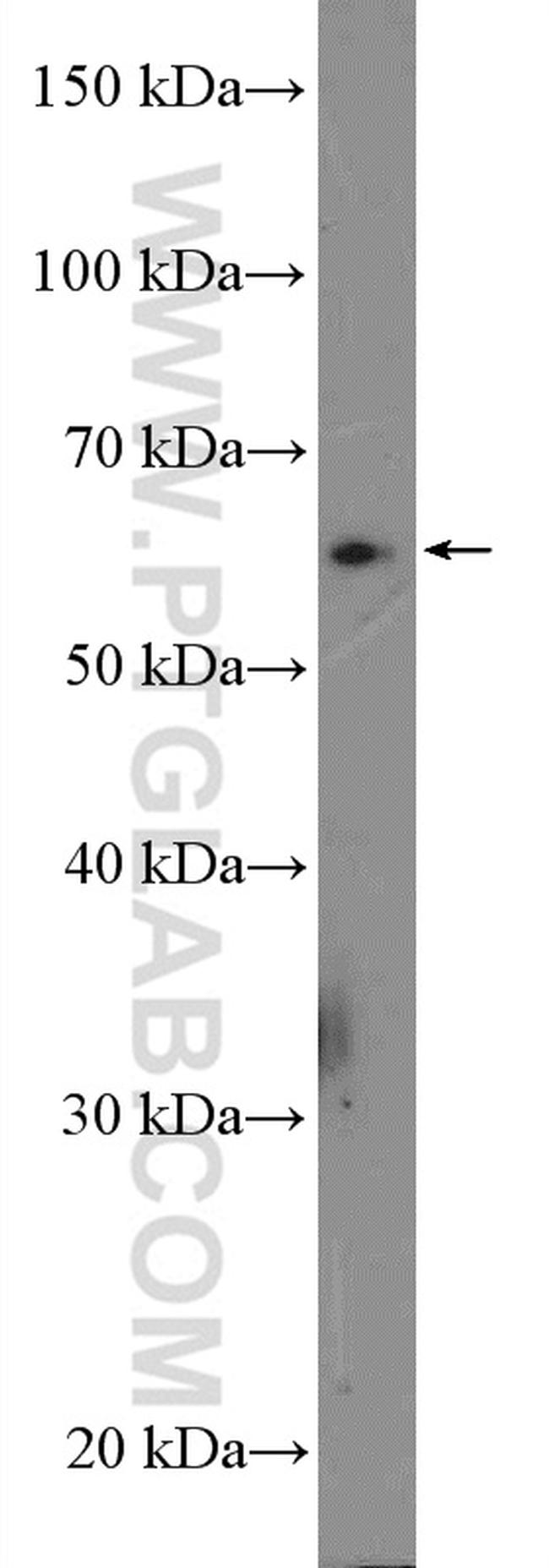 SLC13A3 Antibody in Western Blot (WB)