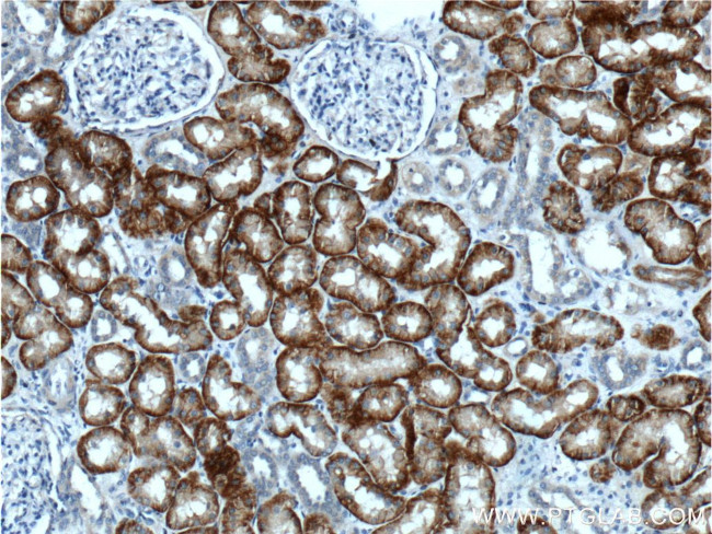 NaDC3 Antibody in Immunohistochemistry (Paraffin) (IHC (P))