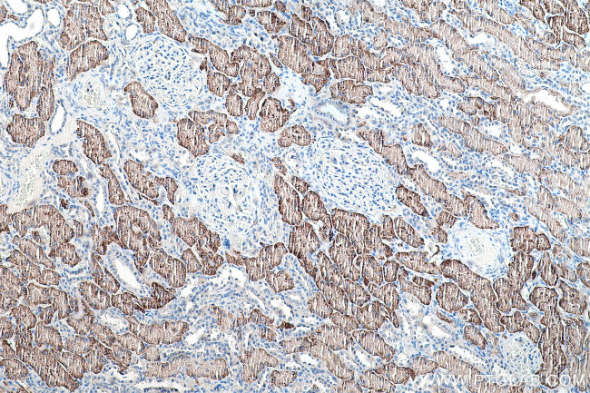 NaDC3 Antibody in Immunohistochemistry (Paraffin) (IHC (P))