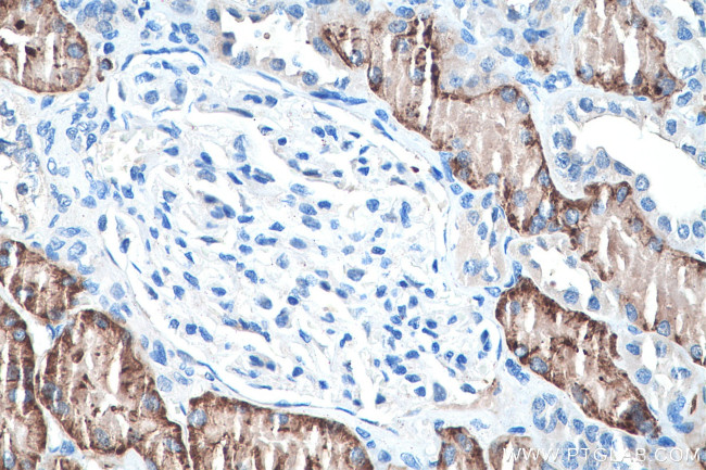 NaDC3 Antibody in Immunohistochemistry (Paraffin) (IHC (P))