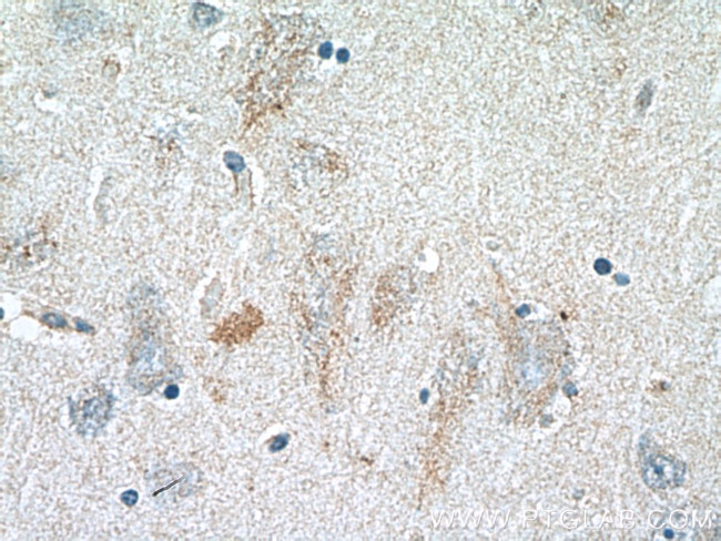 GLDN Antibody in Immunohistochemistry (Paraffin) (IHC (P))