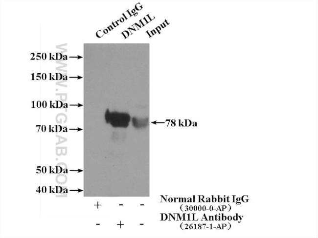 DRP1 (N-terminal) Antibody in Immunoprecipitation (IP)