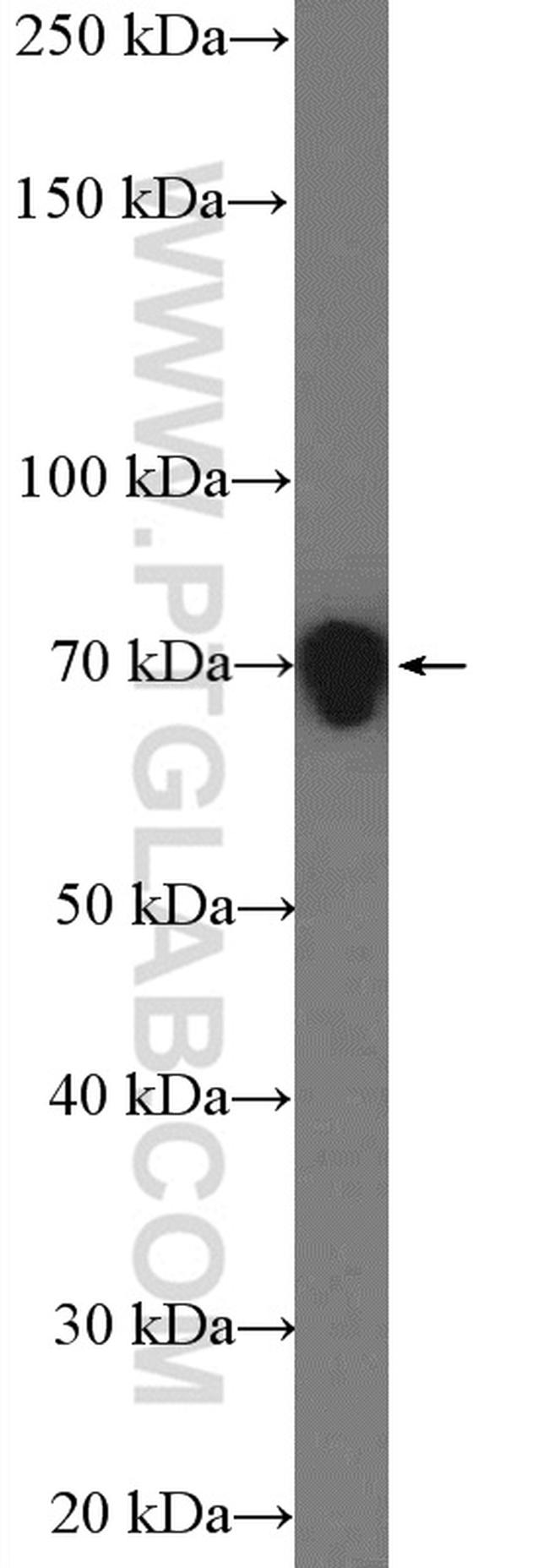 DRP1 (N-terminal) Antibody in Western Blot (WB)