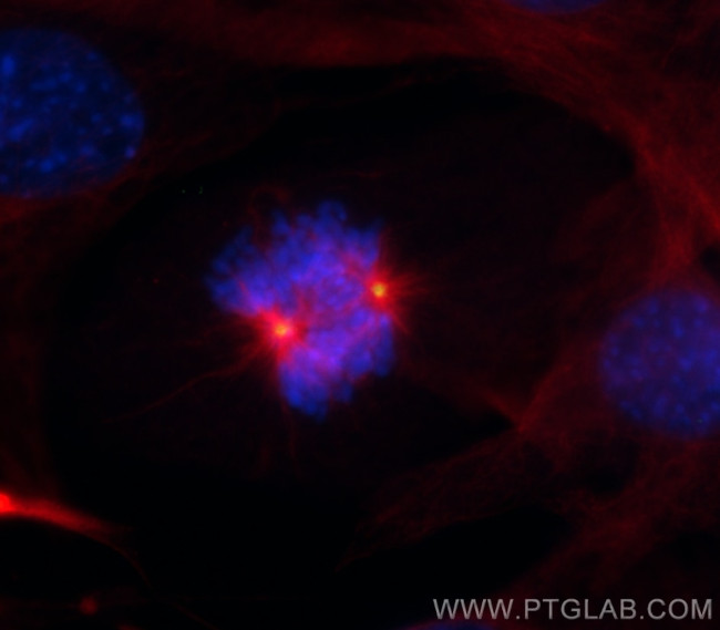 gamma tubulin Antibody in Immunocytochemistry (ICC/IF)