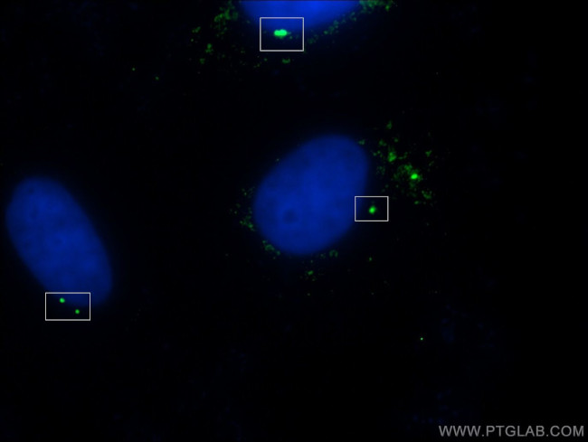 gamma tubulin Antibody in Immunocytochemistry (ICC/IF)