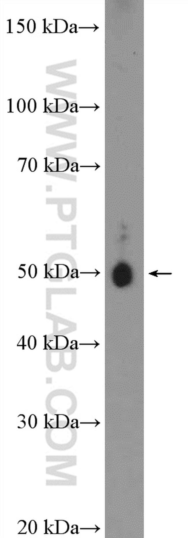 gamma tubulin Antibody in Western Blot (WB)