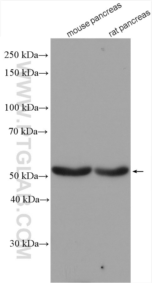 GLP1R Antibody in Western Blot (WB)