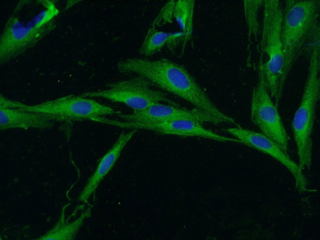 Unc119b Antibody in Immunocytochemistry (ICC/IF)