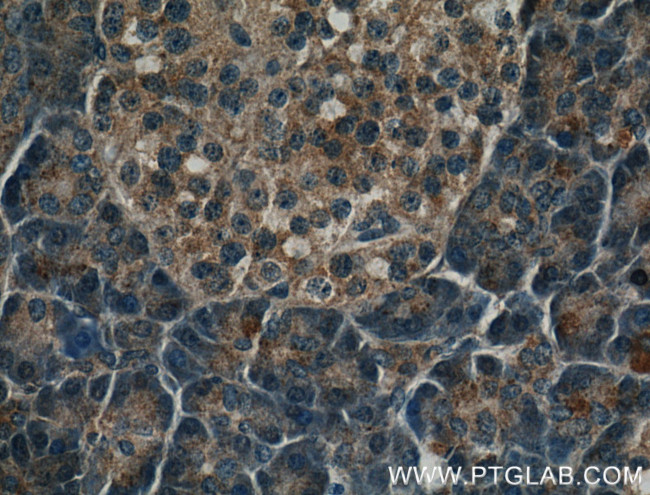 PNLIPRP2 Antibody in Immunohistochemistry (Paraffin) (IHC (P))