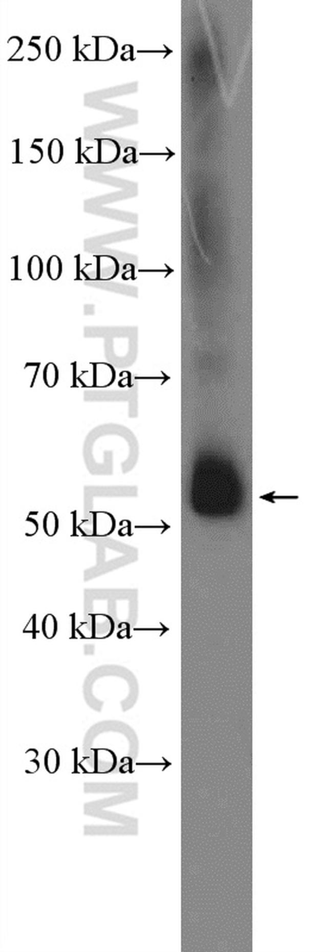 PNLIPRP2 Antibody in Western Blot (WB)