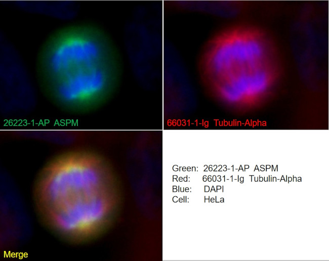 ASPM Antibody in Immunocytochemistry (ICC/IF)