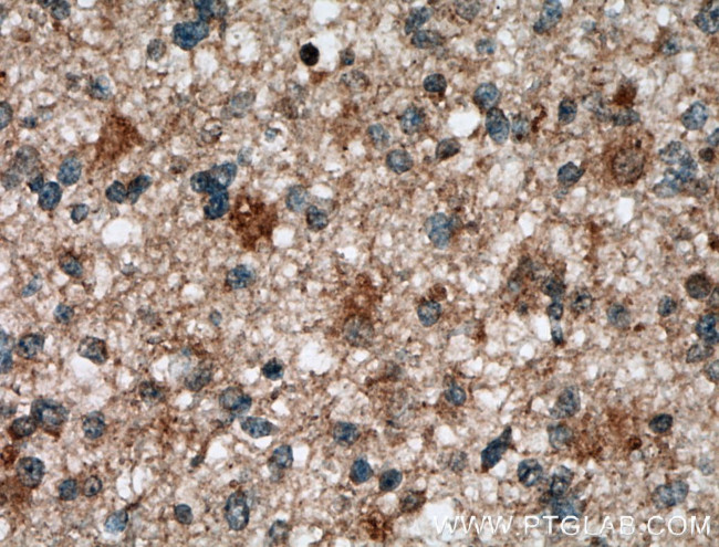 ASPM Antibody in Immunohistochemistry (Paraffin) (IHC (P))