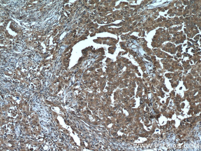 ASPM Antibody in Immunohistochemistry (Paraffin) (IHC (P))