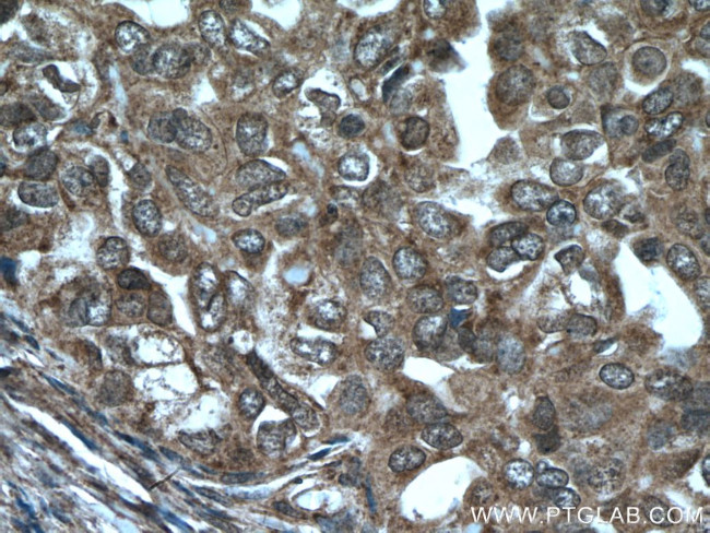 ASPM Antibody in Immunohistochemistry (Paraffin) (IHC (P))